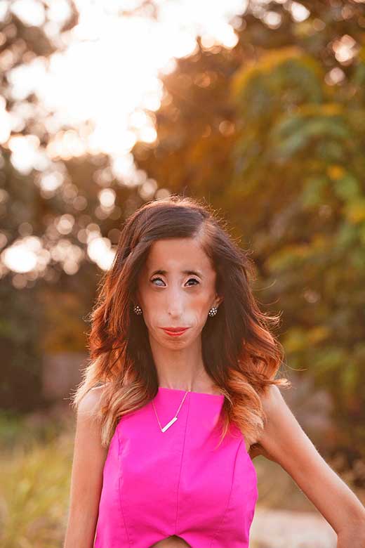 Lizzie Velasquez